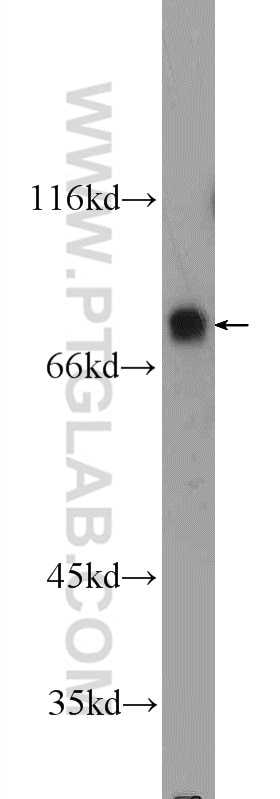 Western Blot (WB) analysis of Jurkat cells using SP2 Polyclonal antibody (25000-1-AP)