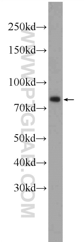 Western Blot (WB) analysis of K-562 cells using SP2 Polyclonal antibody (25000-1-AP)