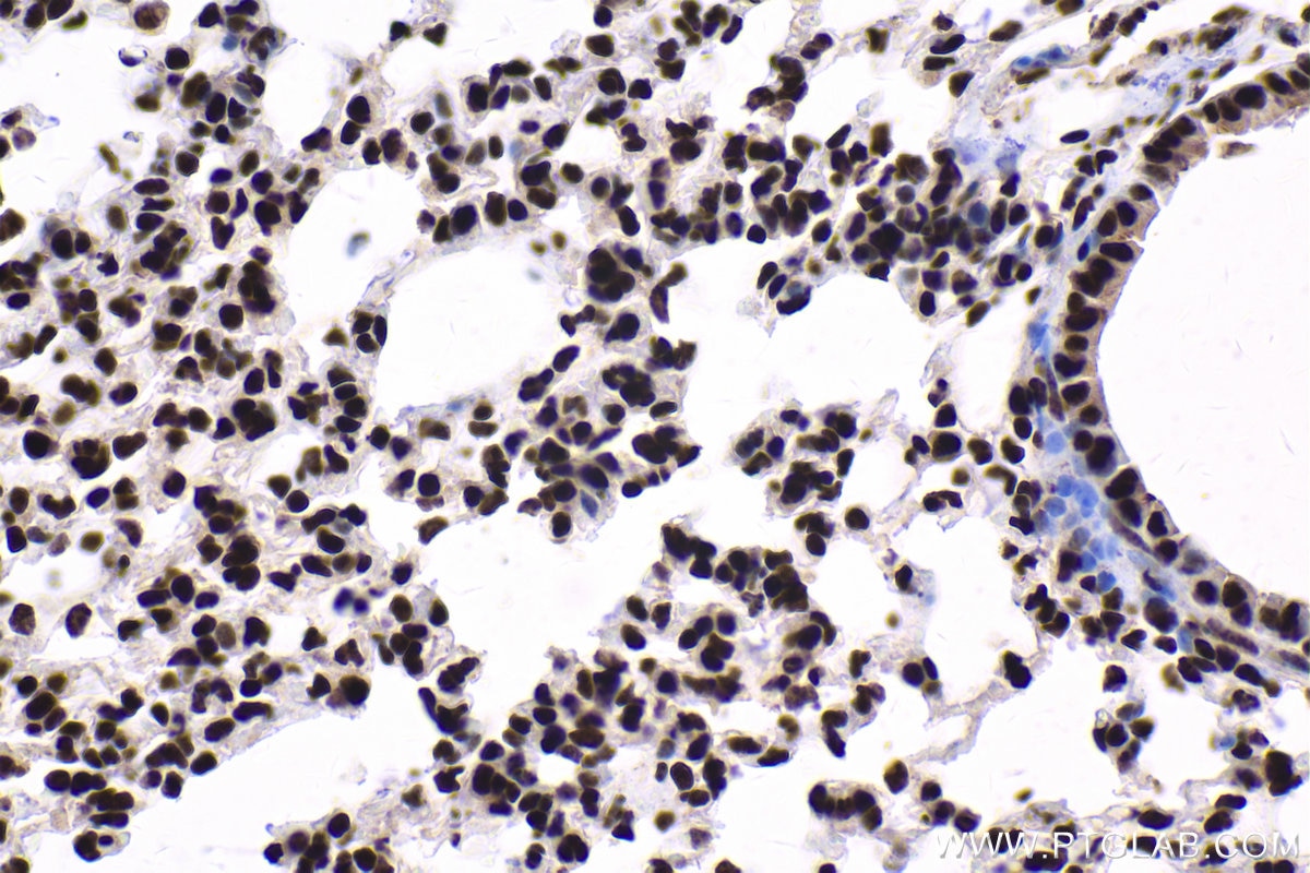 Immunohistochemistry (IHC) staining of mouse lung tissue using SP3 Polyclonal antibody (26584-1-AP)