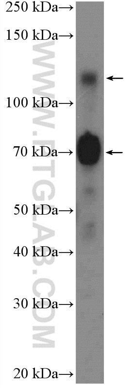 Western Blot (WB) analysis of COLO 320 cells using SP3 Polyclonal antibody (26584-1-AP)