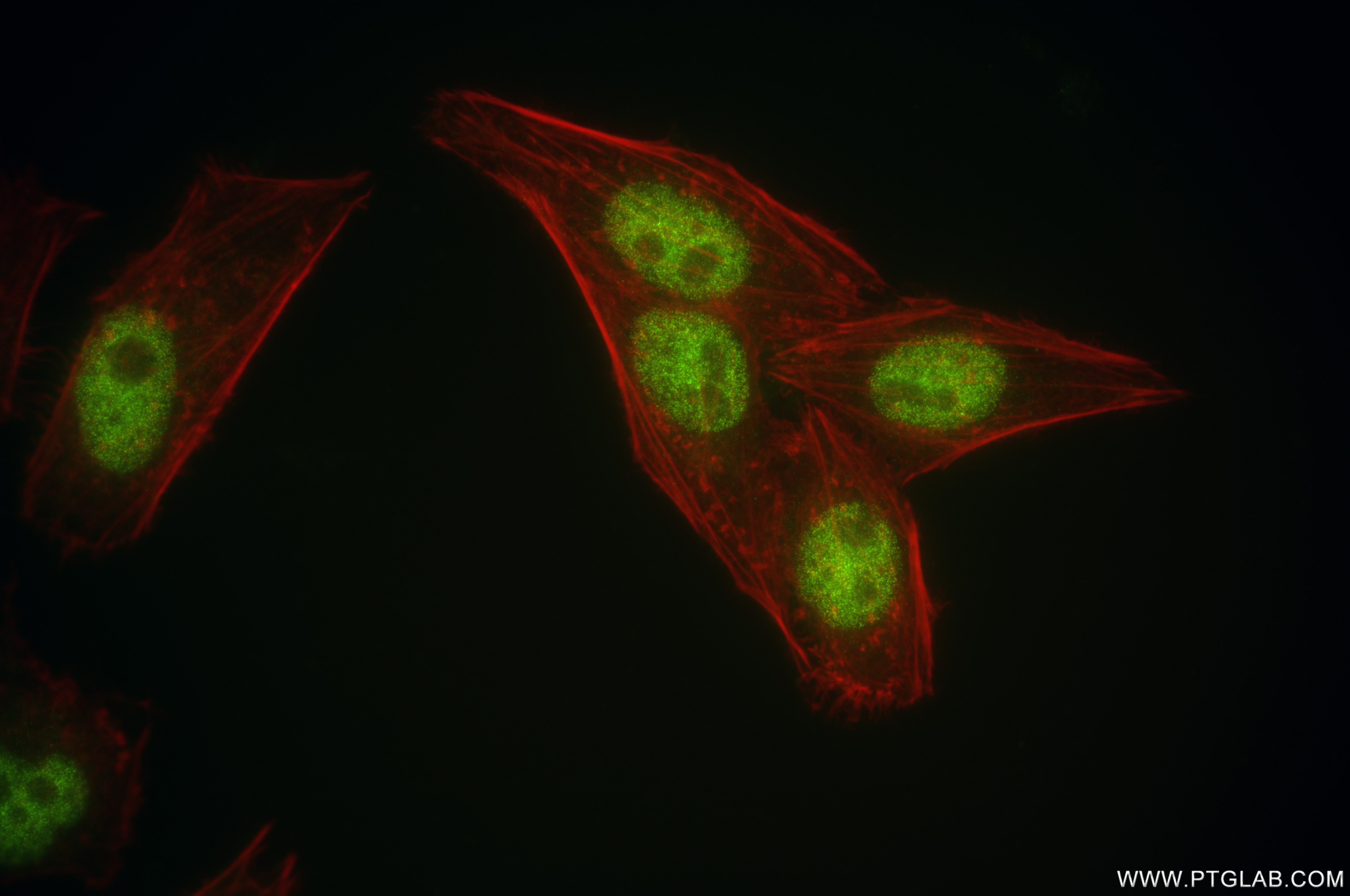 Immunofluorescence (IF) / fluorescent staining of HepG2 cells using SP3 Recombinant antibody (85050-1-RR)