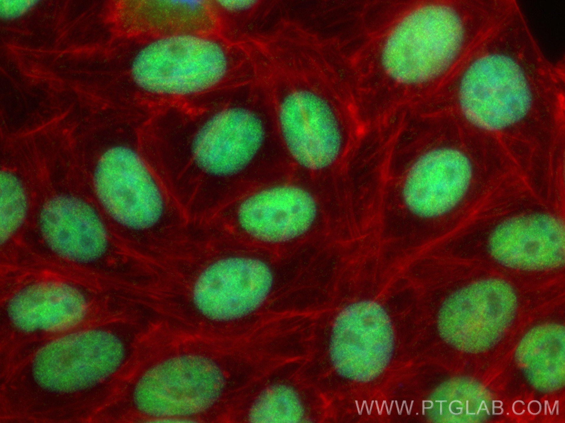Immunofluorescence (IF) / fluorescent staining of HepG2 cells using SP3 Recombinant antibody (85050-1-RR)