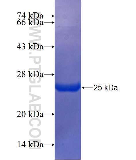 SP3 fusion protein Ag25103 SDS-PAGE