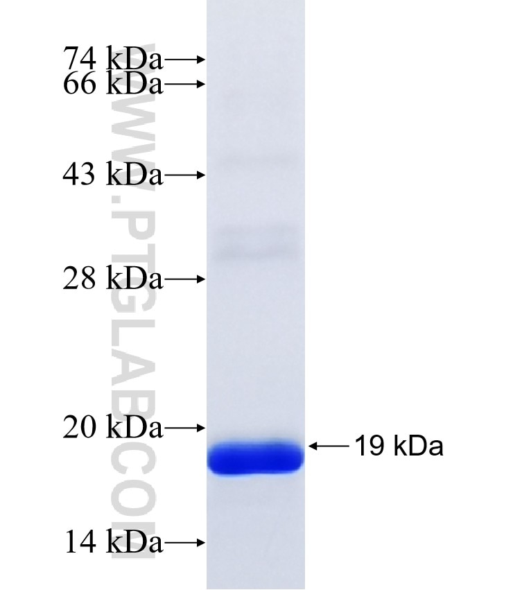 SP5 fusion protein Ag41048 SDS-PAGE
