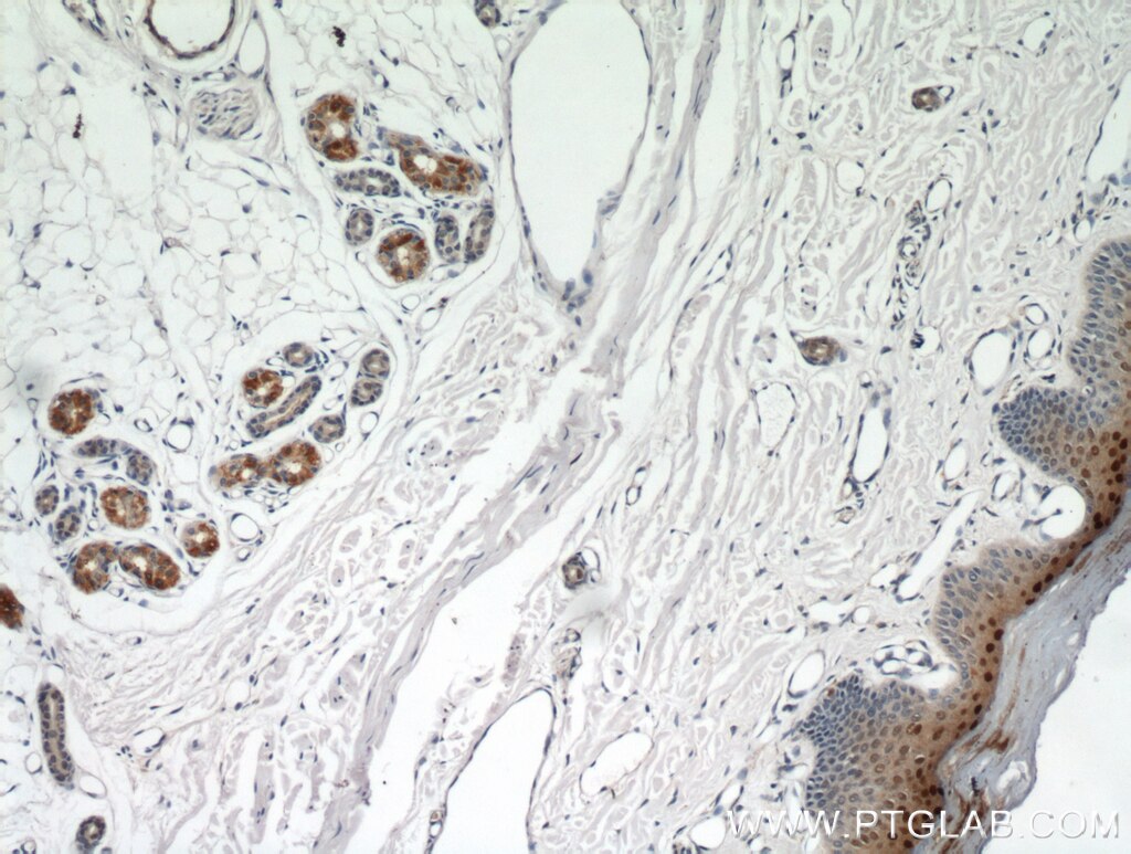 Immunohistochemistry (IHC) staining of human skin tissue using SP6 Polyclonal antibody (21234-1-AP)