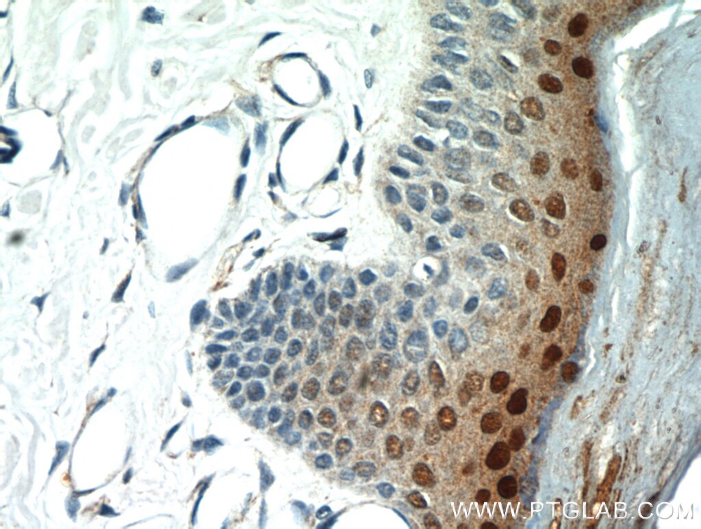 Immunohistochemistry (IHC) staining of human skin tissue using SP6 Polyclonal antibody (21234-1-AP)