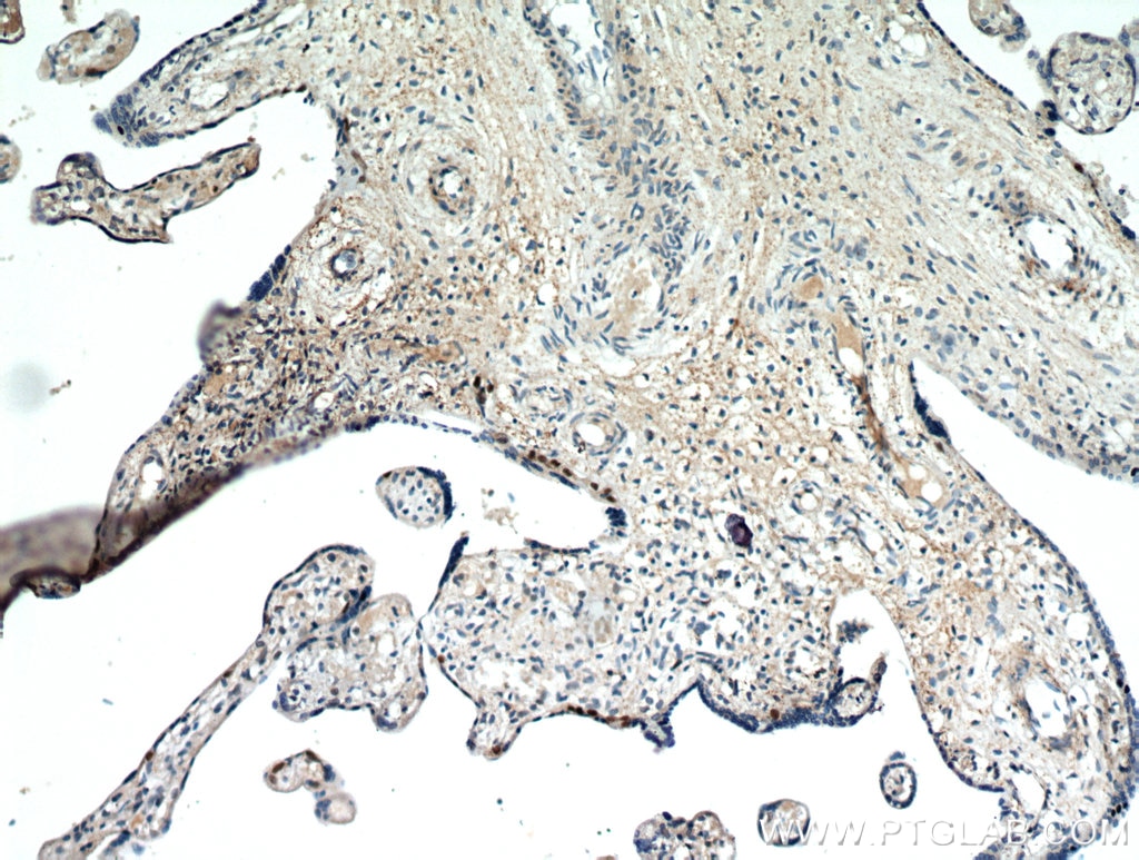 IHC staining of human placenta using 21234-1-AP