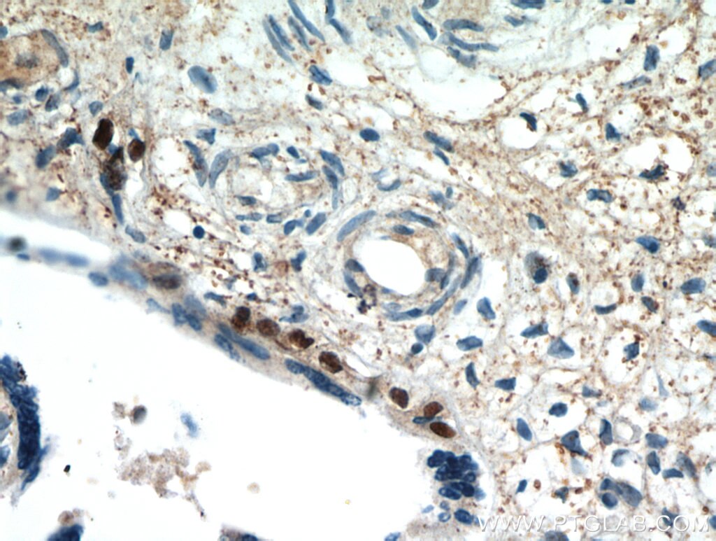 Immunohistochemistry (IHC) staining of human placenta tissue using SP6 Polyclonal antibody (21234-1-AP)