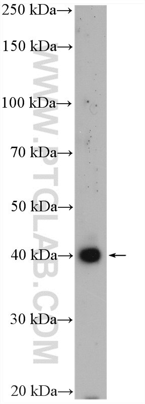 Western Blot (WB) analysis of fetal human brain tissue using SP6 Polyclonal antibody (21234-1-AP)