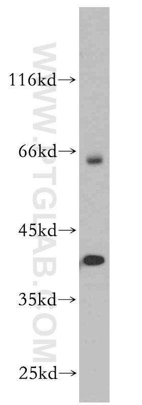 Western Blot (WB) analysis of mouse brain tissue using SP6 Polyclonal antibody (21234-1-AP)