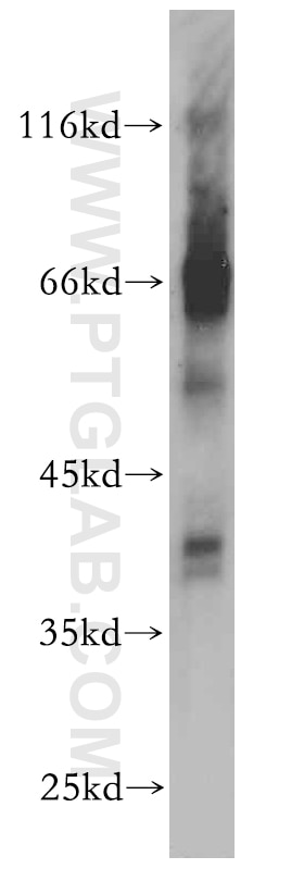 Western Blot (WB) analysis of mouse liver tissue using SP6 Polyclonal antibody (21234-1-AP)