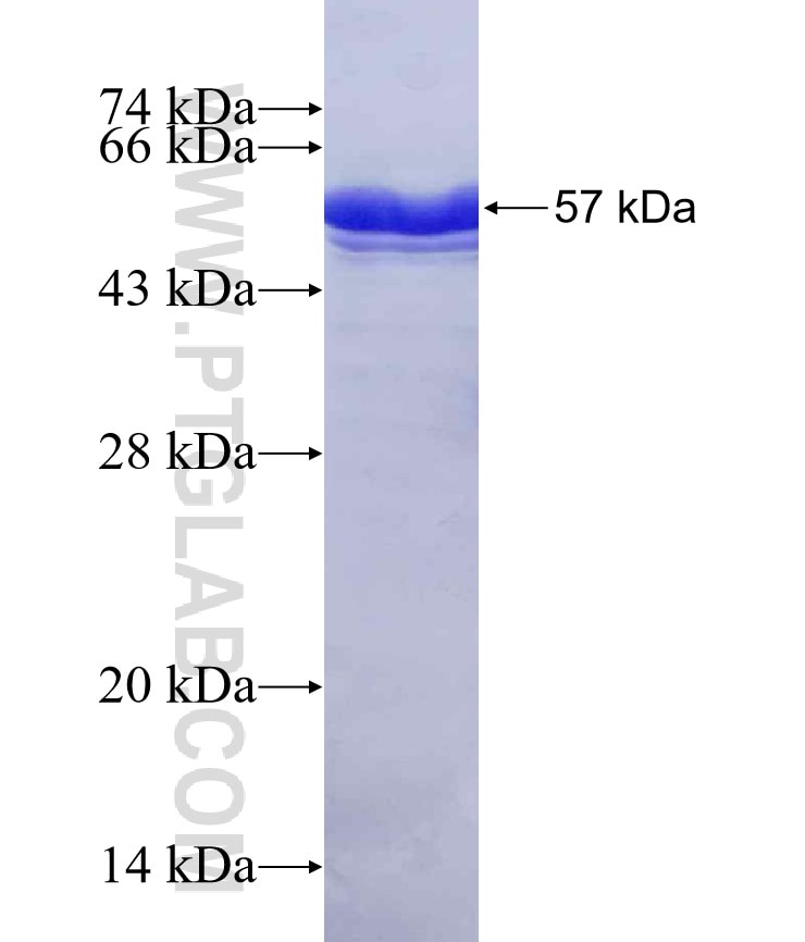 SP6 fusion protein Ag15707 SDS-PAGE