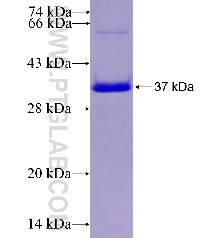 SP6 fusion protein Ag16562 SDS-PAGE