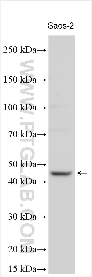 Western Blot (WB) analysis of various lysates using SP7 Polyclonal antibody (28694-1-AP)