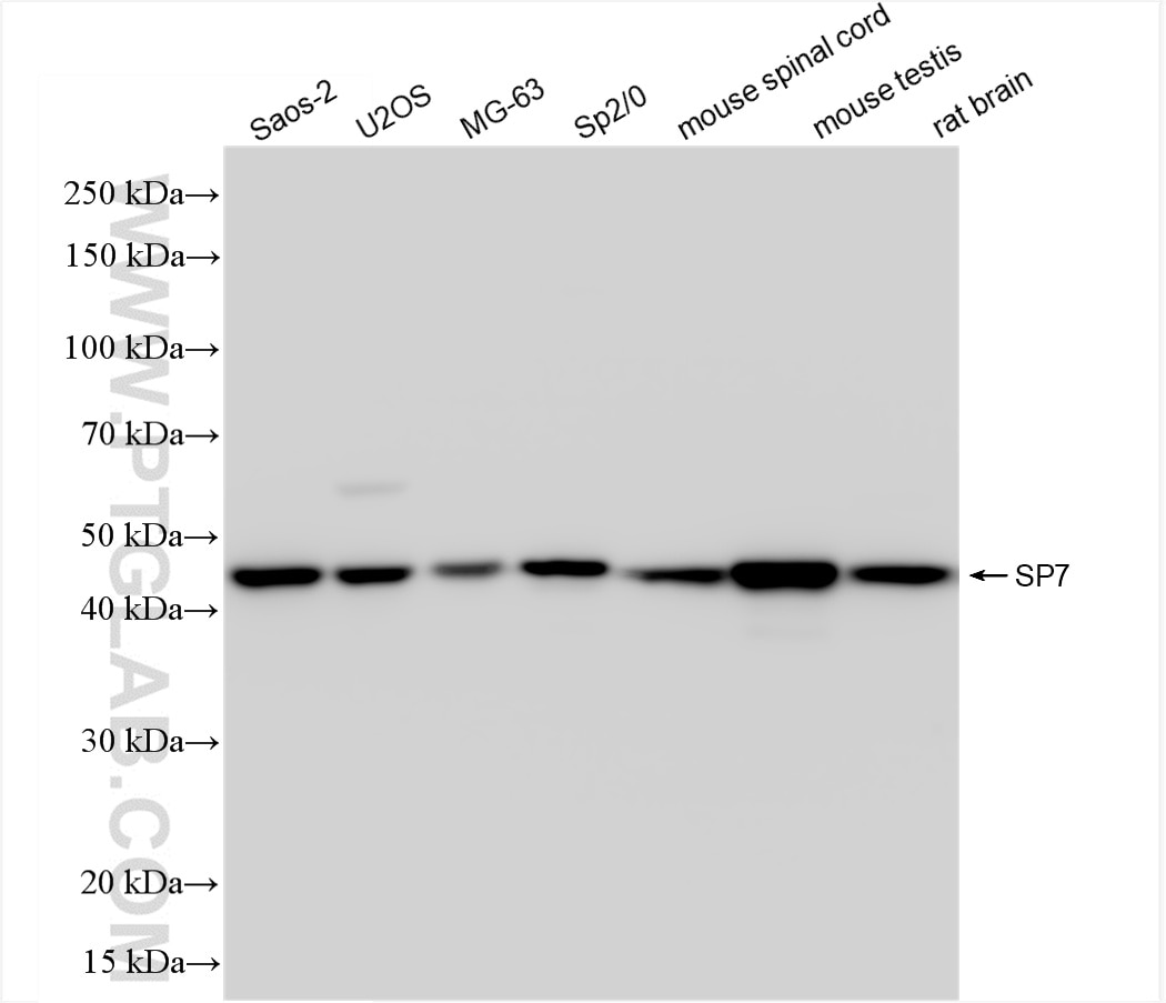 Western Blot (WB) analysis of various lysates using SP7 Recombinant antibody (85934-1-RR)