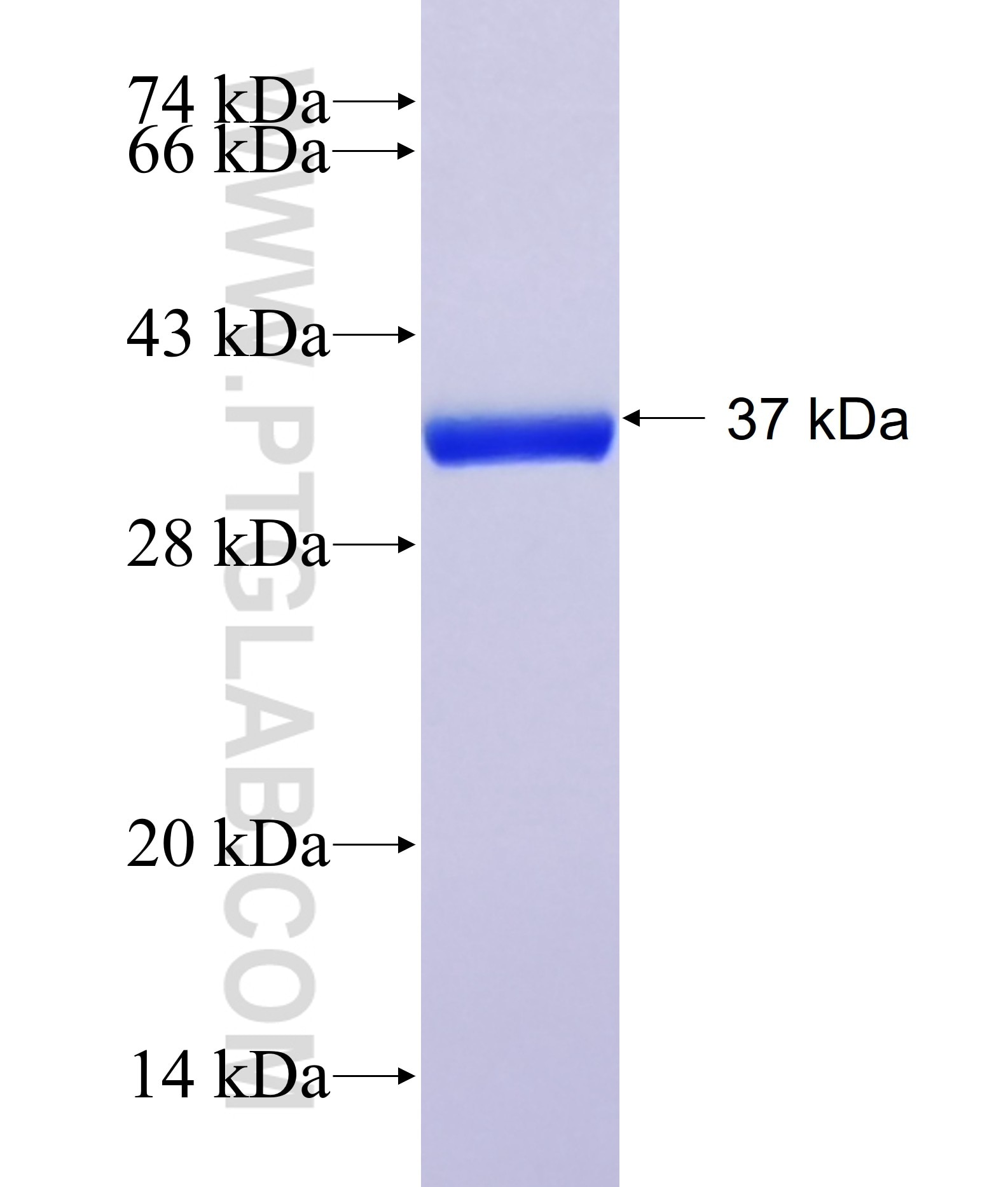 SP9 fusion protein Ag40950 SDS-PAGE