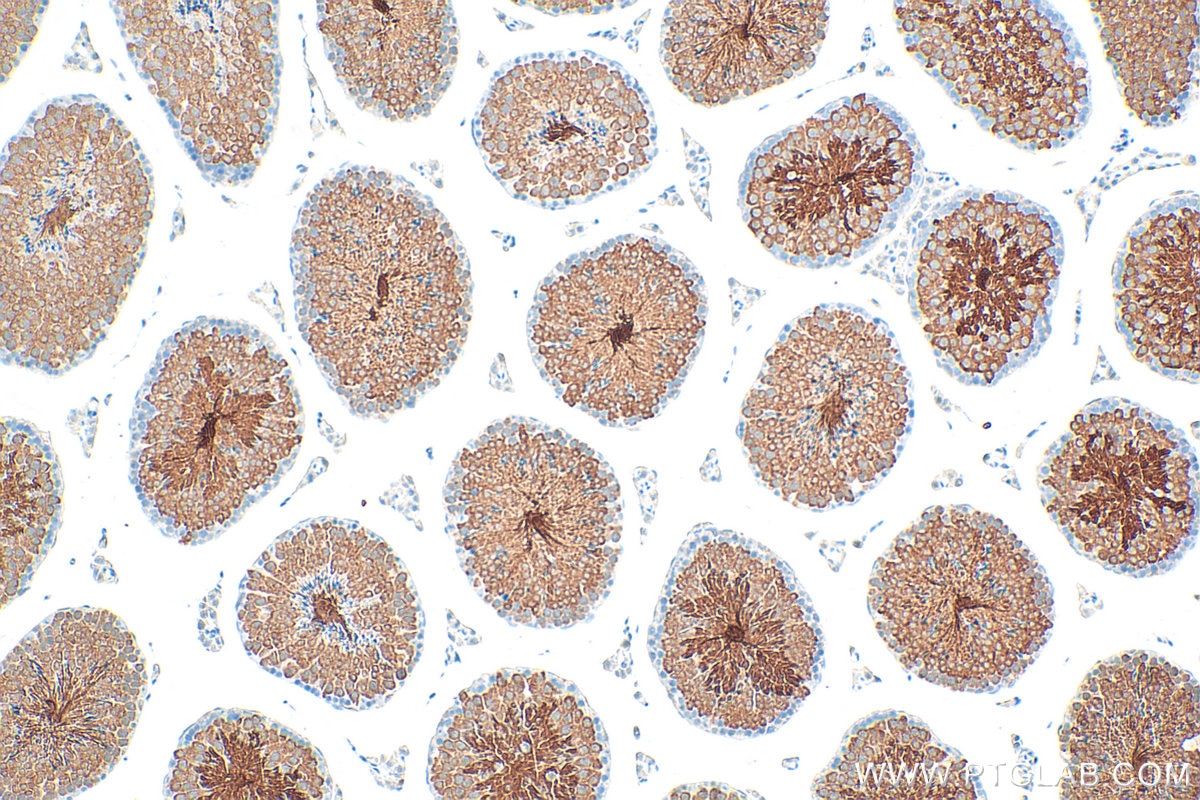 IHC staining of mouse testis using 13367-1-AP (same clone as 13367-1-PBS) Immunohistochemistry (IHC) staining of mouse testis tissue using SPA17 Polyclonal antibody (13367-1-AP)