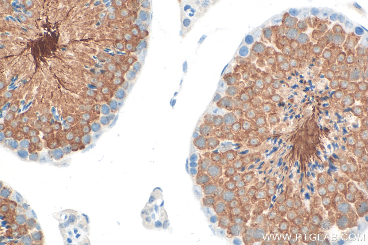 IHC staining of mouse testis using 13367-1-AP (same clone as 13367-1-PBS) Immunohistochemistry (IHC) staining of mouse testis tissue using SPA17 Polyclonal antibody (13367-1-AP)