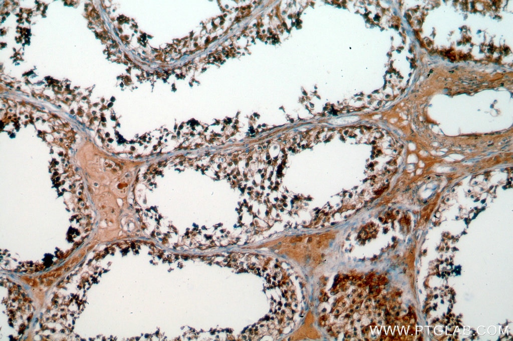 Immunohistochemistry (IHC) staining of human testis tissue using SPA17 Polyclonal antibody (13367-1-AP)