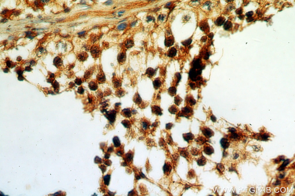 Immunohistochemistry (IHC) staining of human testis tissue using SPA17 Polyclonal antibody (13367-1-AP)