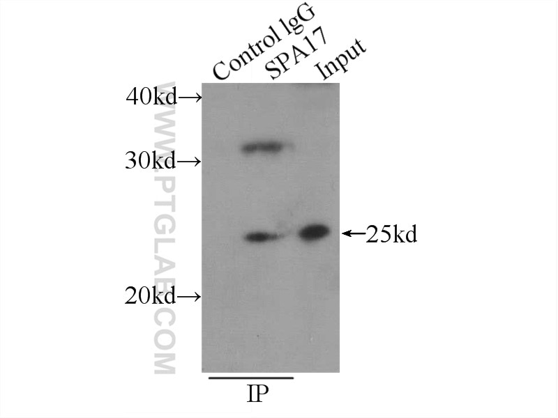 Immunoprecipitation (IP) experiment of mouse testis tissue using SPA17 Polyclonal antibody (13367-1-AP)