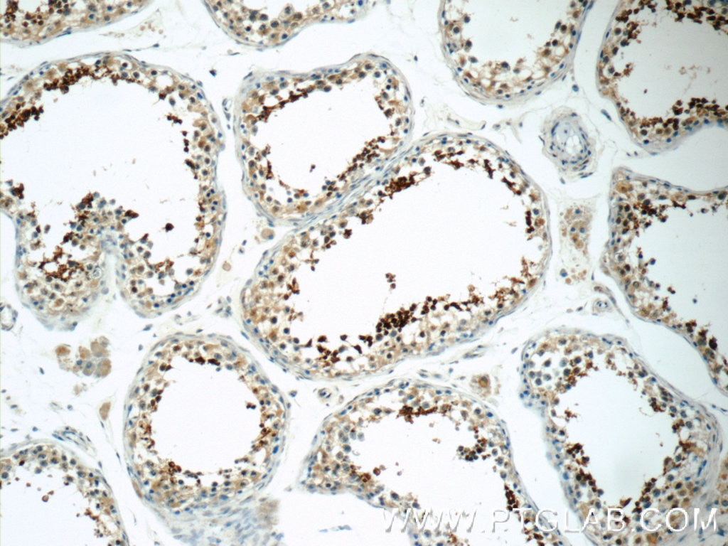 Immunohistochemistry (IHC) staining of human testis tissue using SPACA1 Polyclonal antibody (12829-1-AP)