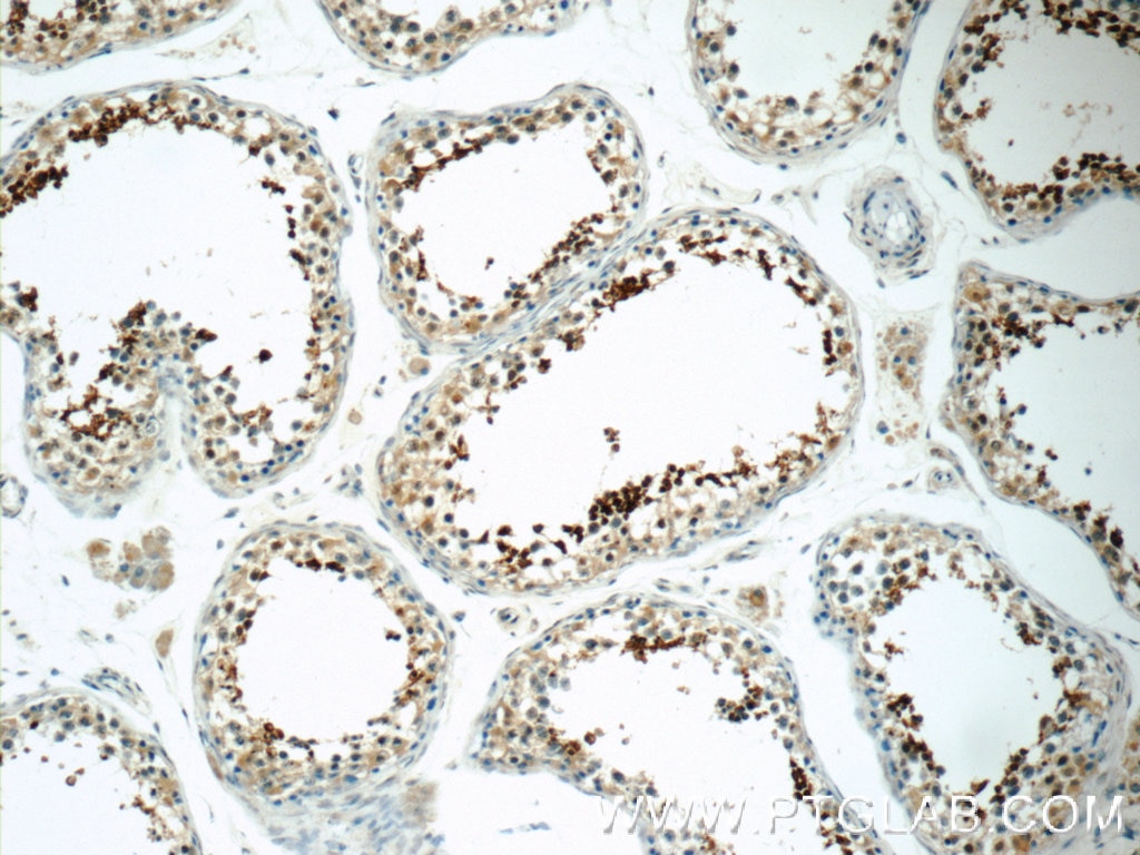 IHC staining of human testis using 12829-1-AP