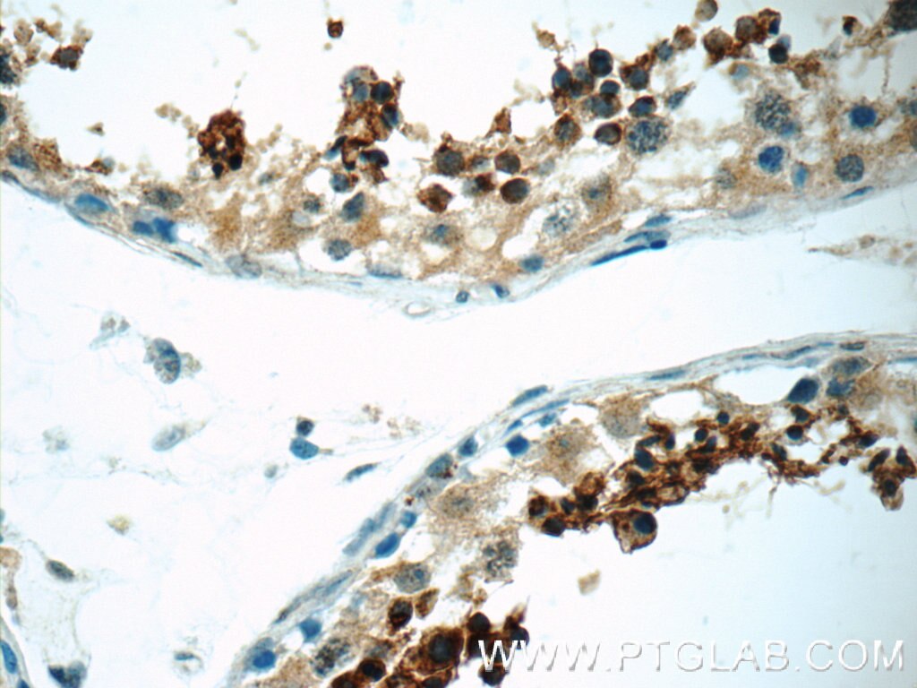 Immunohistochemistry (IHC) staining of human testis tissue using SPACA1 Polyclonal antibody (12829-1-AP)