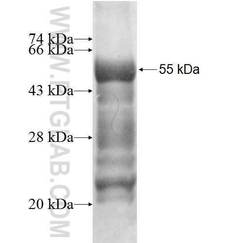 SPACA1 fusion protein Ag3549 SDS-PAGE