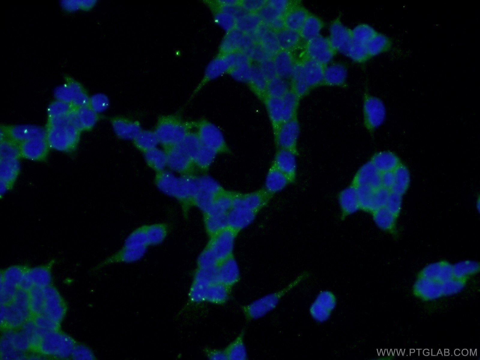 Immunofluorescence (IF) / fluorescent staining of HEK-293 cells using SPACA3 Polyclonal antibody (21137-1-AP)