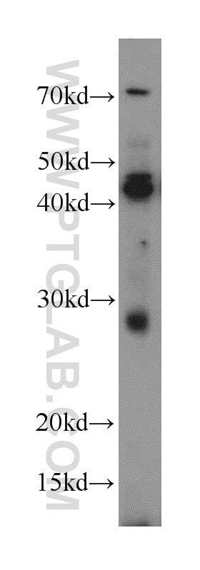 Western Blot (WB) analysis of HEK-293 cells using SPACA3 Polyclonal antibody (21137-1-AP)