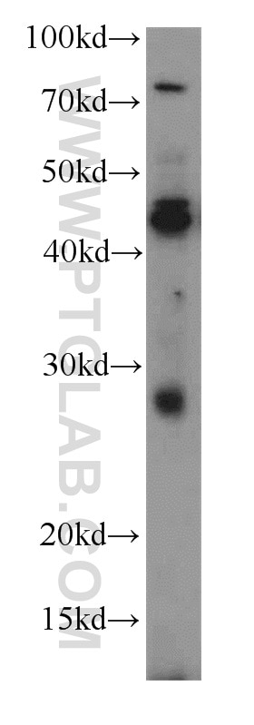 Western Blot (WB) analysis of HEK-293 cells using SPACA3 Polyclonal antibody (21137-1-AP)