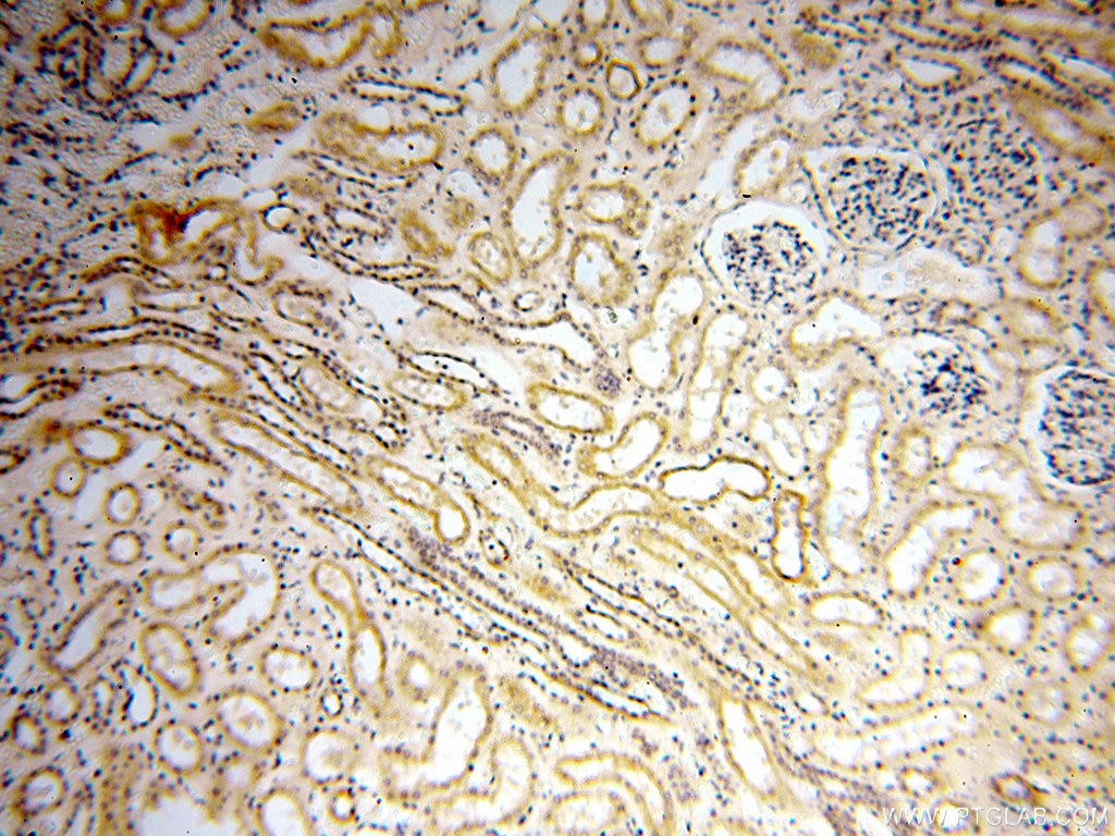 Immunohistochemistry (IHC) staining of human kidney tissue using SPAG11A Polyclonal antibody (16770-1-AP)