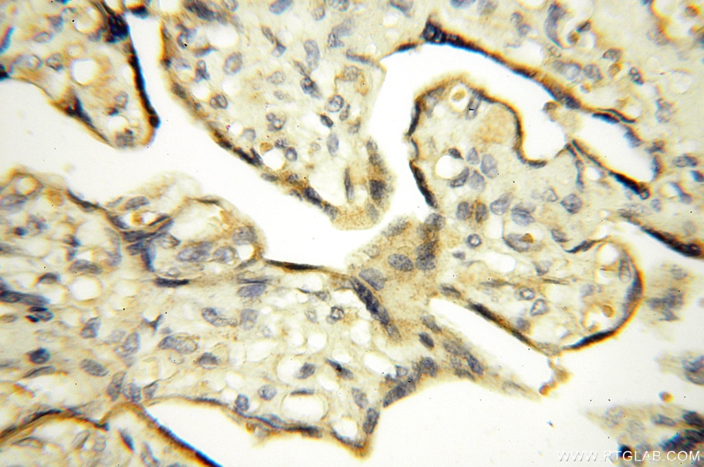 Immunohistochemistry (IHC) staining of human placenta tissue using SPAG11A Polyclonal antibody (16770-1-AP)