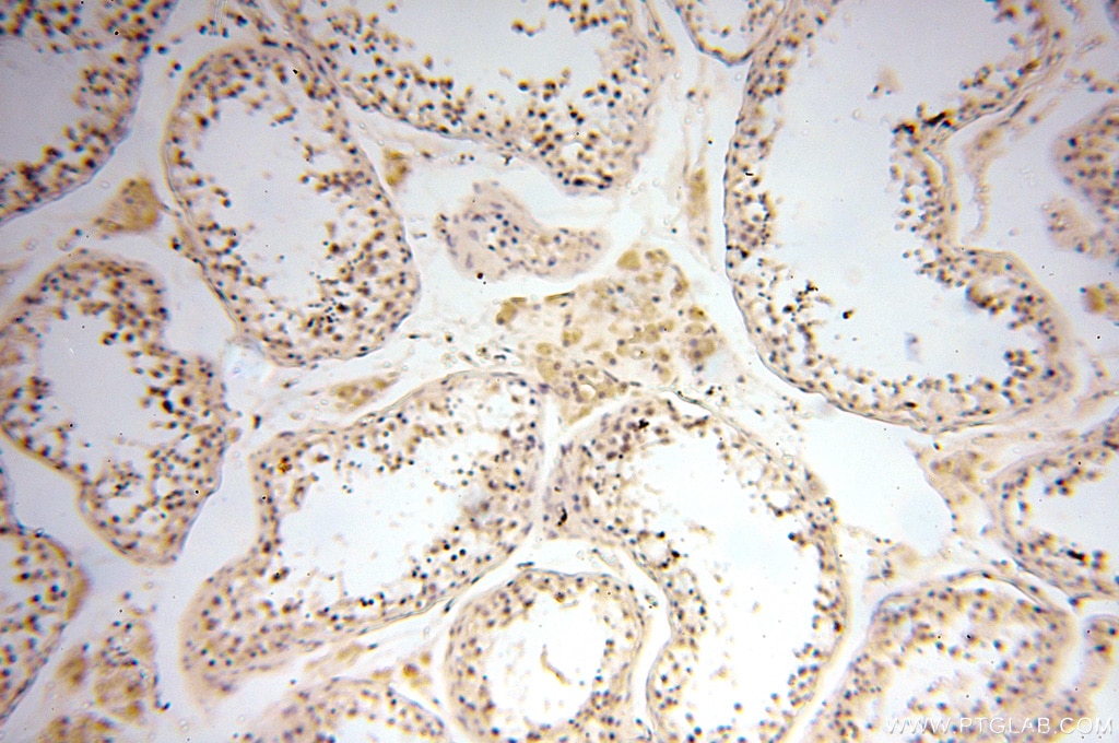 Immunohistochemistry (IHC) staining of human testis tissue using SPAG11A Polyclonal antibody (16770-1-AP)