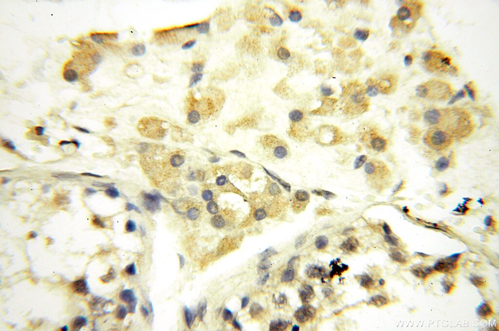 Immunohistochemistry (IHC) staining of human testis tissue using SPAG11A Polyclonal antibody (16770-1-AP)