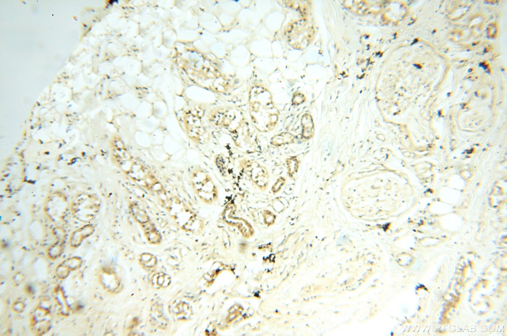 Immunohistochemistry (IHC) staining of human skin tissue using SPAG11A Polyclonal antibody (16770-1-AP)