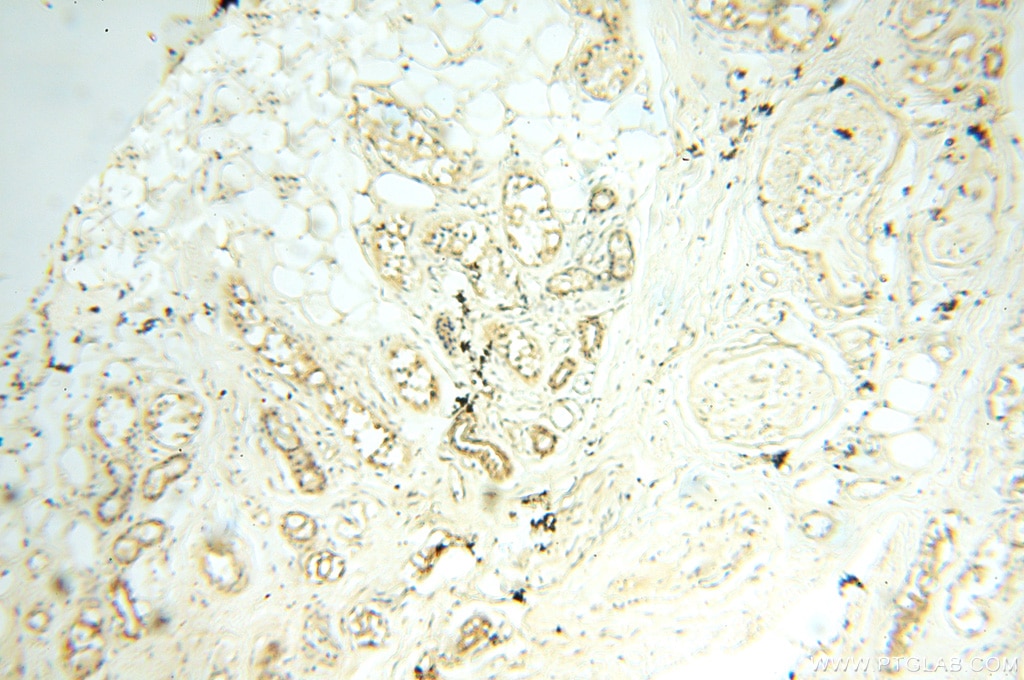 IHC staining of human skin using 16770-1-AP