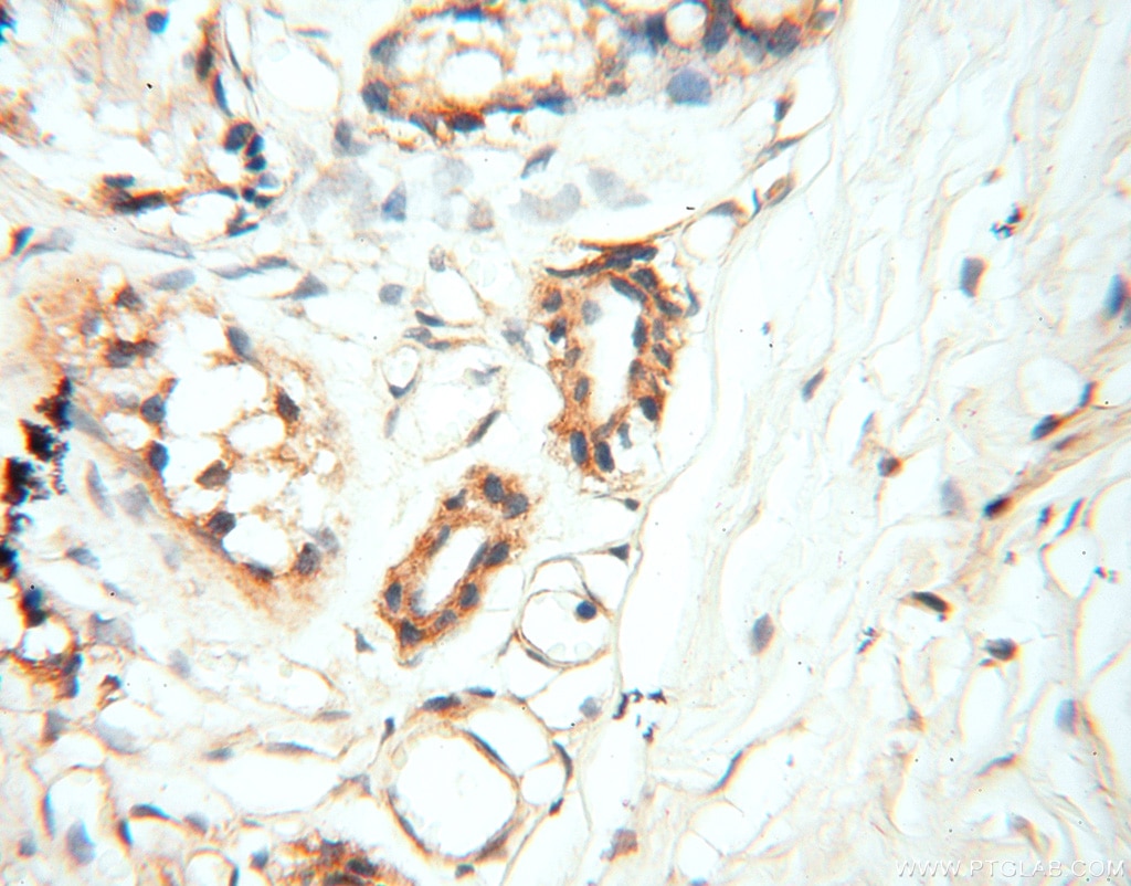 Immunohistochemistry (IHC) staining of human skin tissue using SPAG11A Polyclonal antibody (16770-1-AP)