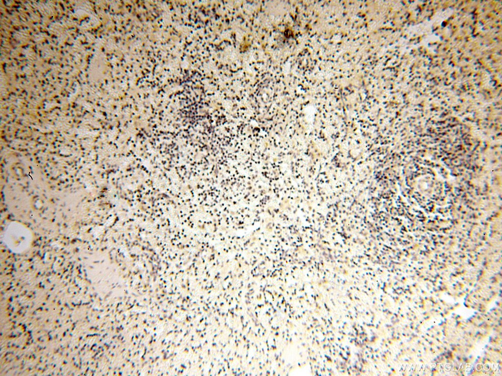 Immunohistochemistry (IHC) staining of human spleen tissue using SPAG11A Polyclonal antibody (16770-1-AP)