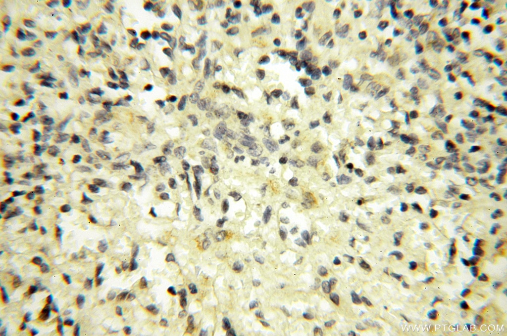 Immunohistochemistry (IHC) staining of human spleen tissue using SPAG11A Polyclonal antibody (16770-1-AP)