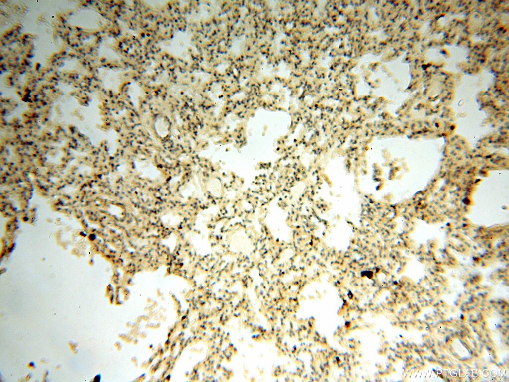 Immunohistochemistry (IHC) staining of human lung tissue using SPAG11A Polyclonal antibody (16770-1-AP)