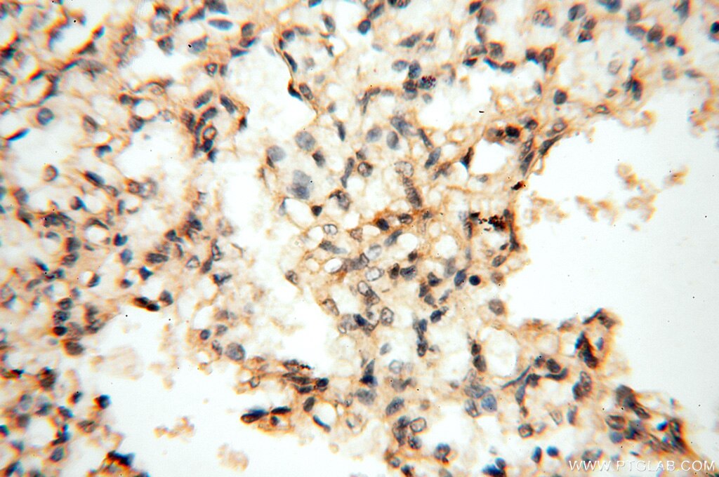 Immunohistochemistry (IHC) staining of human lung tissue using SPAG11A Polyclonal antibody (16770-1-AP)