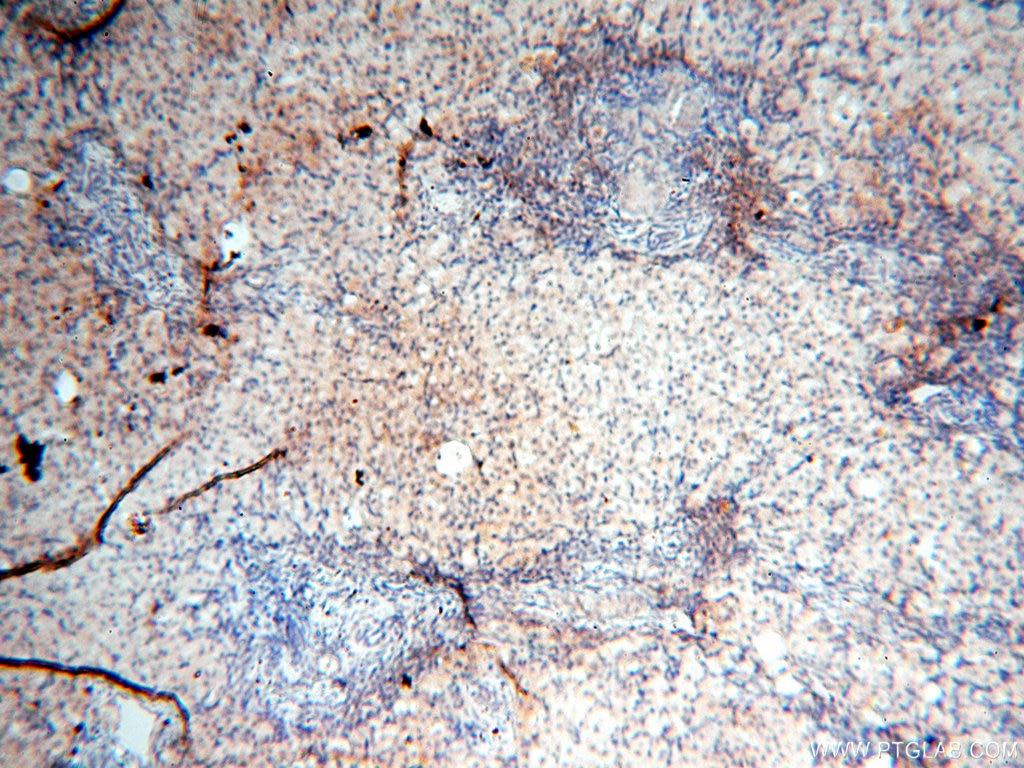 Immunohistochemistry (IHC) staining of human ovary tissue using SPAG11A Polyclonal antibody (16770-1-AP)