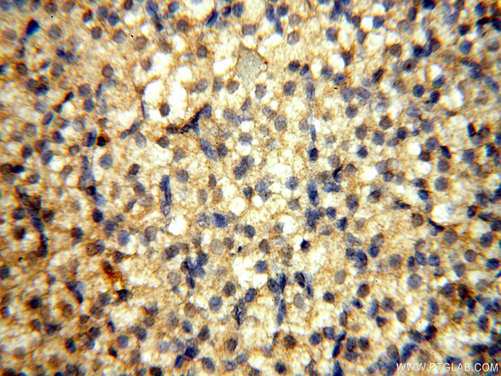 Immunohistochemistry (IHC) staining of human ovary tissue using SPAG11A Polyclonal antibody (16770-1-AP)