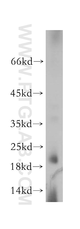 Western Blot (WB) analysis of human brain tissue using SPAG11A Polyclonal antibody (16770-1-AP)