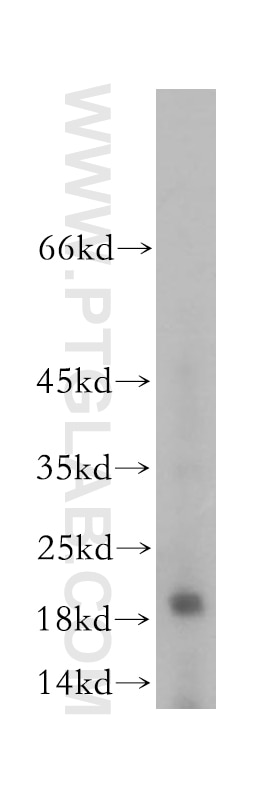 Western Blot (WB) analysis of human testis tissue using SPAG11A Polyclonal antibody (16770-1-AP)