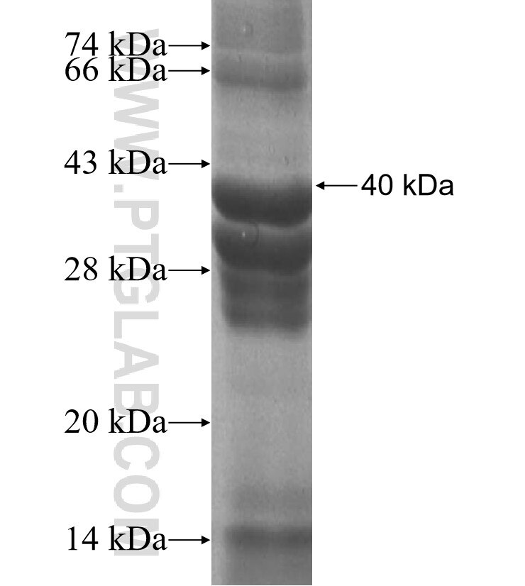 SPAG11A fusion protein Ag9846 SDS-PAGE