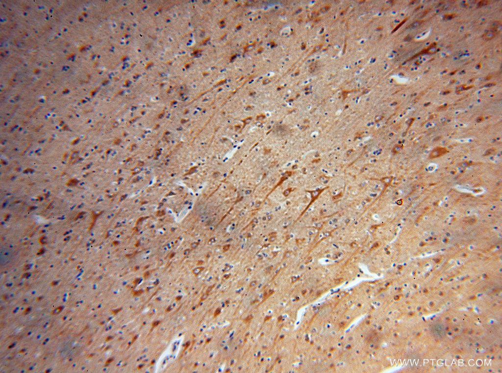 Immunohistochemistry (IHC) staining of human brain tissue using SPAG16 Polyclonal antibody (16883-1-AP)