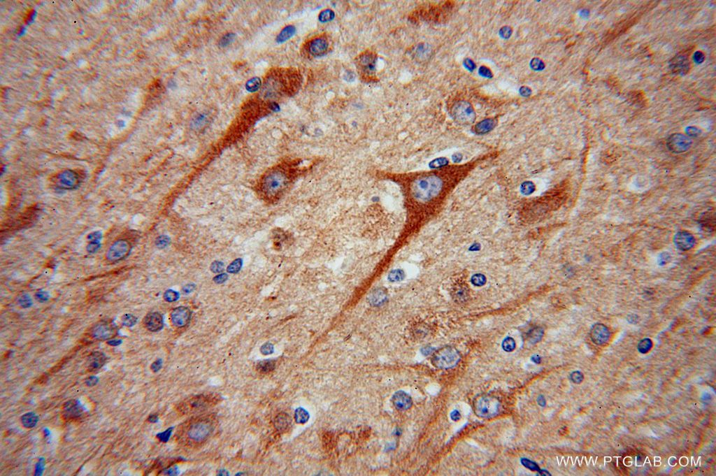Immunohistochemistry (IHC) staining of human brain tissue using SPAG16 Polyclonal antibody (16883-1-AP)